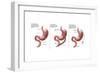 Digestive System: Normal, Gastric Band, Bypass-Gwen Shockey-Framed Art Print