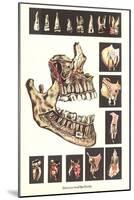 Diseases of the Teeth-null-Mounted Art Print