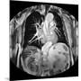 Dissecting Aorta, MRI Scan-Du Cane Medical-Mounted Photographic Print
