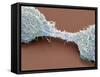 Dividing Brain Cancer Cells, SEM-Steve Gschmeissner-Framed Stretched Canvas