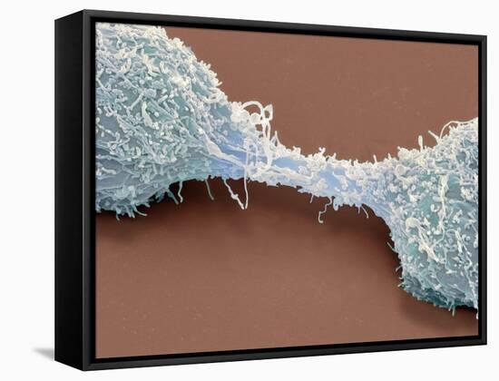 Dividing Brain Cancer Cells, SEM-Steve Gschmeissner-Framed Stretched Canvas