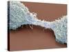 Dividing Brain Cancer Cells, SEM-Steve Gschmeissner-Stretched Canvas