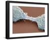 Dividing Brain Cancer Cells, SEM-Steve Gschmeissner-Framed Photographic Print