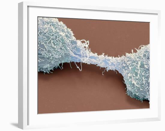 Dividing Brain Cancer Cells, SEM-Steve Gschmeissner-Framed Photographic Print