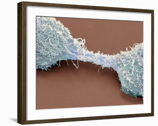 Dividing Brain Cancer Cells, SEM-Steve Gschmeissner-Framed Photographic Print