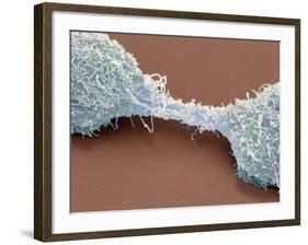 Dividing Brain Cancer Cells, SEM-Steve Gschmeissner-Framed Photographic Print