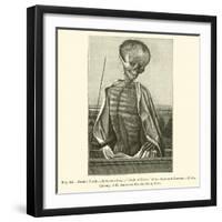 Doctor Death-null-Framed Giclee Print