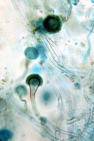 Brown Mould Fungus, Light Micrograph