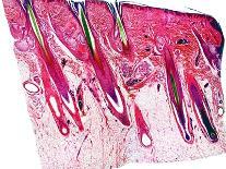 Skin Section, Light Micrograph-Dr. Keith Wheeler-Photographic Print