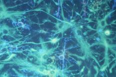 Brain Cells-Dr. Neal Scolding-Mounted Photographic Print