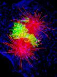 Cancer Cell Division-Dr. Paul Andrews-Photographic Print