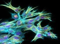 Fibroblast Cells Showing Cytoskeleton-Dr. Torsten Wittmann-Photographic Print