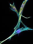 Lung Cells, Fluorescent Micrograph-Dr. Torsten Wittmann-Photographic Print