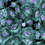 Fibroblast Cells, Fluorescent Micrograph-Dr. Torsten Wittmann-Photographic Print