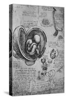 'Drawings of an Embryo in the Uterus', c1480 (1945)-Leonardo Da Vinci-Stretched Canvas