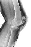 Normal Foot, X-ray-Du Cane Medical-Photographic Print