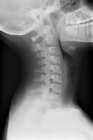 Healthy Spine of the Neck, X-ray'-Du Cane Medical-Photographic Print