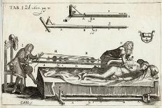 Surgeons Setting a Bone with the Help of Michault's Bone- Setting Apparatus-E.a. Sohn-Art Print