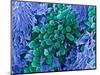 E. Coli Bacteria, SEM-Stephanie Schuller-Mounted Premium Photographic Print