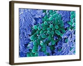 E. Coli Bacteria, SEM-Stephanie Schuller-Framed Photographic Print