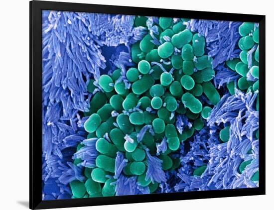 E. Coli Bacteria, SEM-Stephanie Schuller-Framed Photographic Print