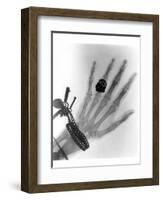 Early X-ray Photograph of a Hand Taken In 1896-Science Photo Library-Framed Photographic Print