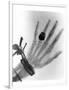 Early X-ray Photograph of a Hand Taken In 1896-Science Photo Library-Framed Photographic Print