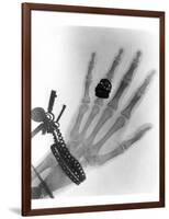 Early X-ray Photograph of a Hand Taken In 1896-Science Photo Library-Framed Photographic Print