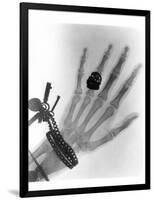 Early X-ray Photograph of a Hand Taken In 1896-Science Photo Library-Framed Photographic Print