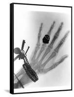 Early X-ray Photograph of a Hand Taken In 1896-Science Photo Library-Framed Stretched Canvas