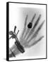 Early X-ray Photograph of a Hand Taken In 1896-Science Photo Library-Framed Stretched Canvas