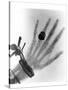 Early X-ray Photograph of a Hand Taken In 1896-Science Photo Library-Stretched Canvas