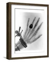 Early X-ray Photograph of a Hand Taken In 1896-Science Photo Library-Framed Photographic Print