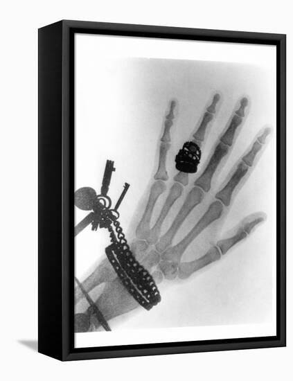 Early X-ray Photograph of a Hand Taken In 1896-Science Photo Library-Framed Stretched Canvas