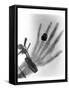 Early X-ray Photograph of a Hand Taken In 1896-Science Photo Library-Framed Stretched Canvas