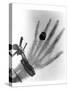 Early X-ray Photograph of a Hand Taken In 1896-Science Photo Library-Stretched Canvas