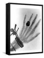 Early X-ray Photograph of a Hand Taken In 1896-Science Photo Library-Framed Stretched Canvas