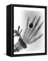 Early X-ray Photograph of a Hand Taken In 1896-Science Photo Library-Framed Stretched Canvas