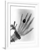 Early X-ray Photograph of a Hand Taken In 1896-Science Photo Library-Framed Premium Photographic Print