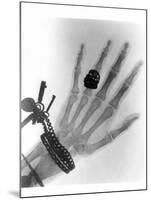 Early X-ray Photograph of a Hand Taken In 1896-Science Photo Library-Mounted Premium Photographic Print