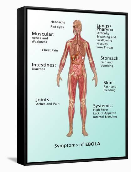 Ebola Virus Symptoms in Human, Illustration-Gwen Shockey-Framed Stretched Canvas