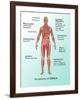 Ebola Virus Symptoms in Human, Illustration-Gwen Shockey-Framed Giclee Print