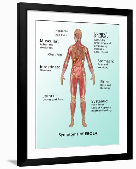 Ebola Virus Symptoms in Human, Illustration-Gwen Shockey-Framed Giclee Print