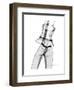 Editorial X-Ray-Albert Koetsier-Framed Premium Giclee Print