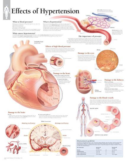 Poster, , large