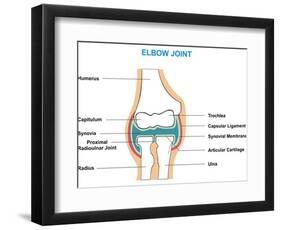 Elbow Joint Cross-Section-udaix-Framed Art Print