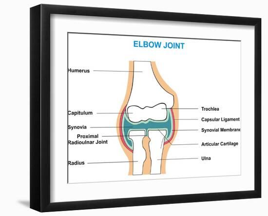 Elbow Joint Cross-Section-udaix-Framed Art Print