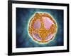 Electron Micrograph of Negative-Stained Prochlorococcus-null-Framed Art Print