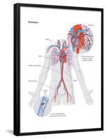 Embolism-Encyclopaedia Britannica-Framed Poster