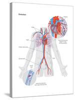 Embolism-Encyclopaedia Britannica-Stretched Canvas